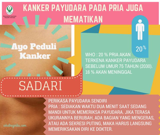 Kangker Payudara Pada Pria Mematikan