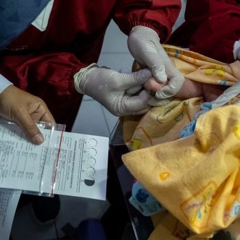 Cegah Retardasi Mental dan Stunting, Kementerian Kesehatan Mewajibkan Skrining Hipotiroid Kongenital (SHK) di Seluruh Fasyankes di Indonesia